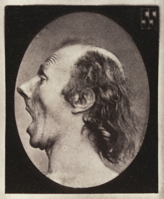 Victorian-era facial expression experiment showing a man with an exaggerated open mouth in a vintage black and white photo.