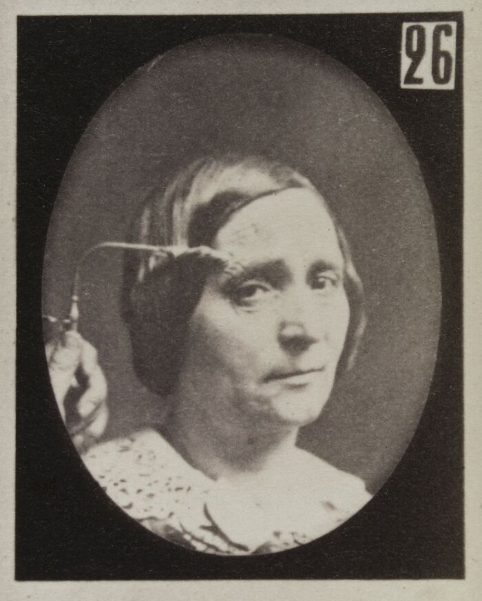 19th century facial expressions experiment showing a woman with a tool manipulating her eyebrow, vintage black and white photo