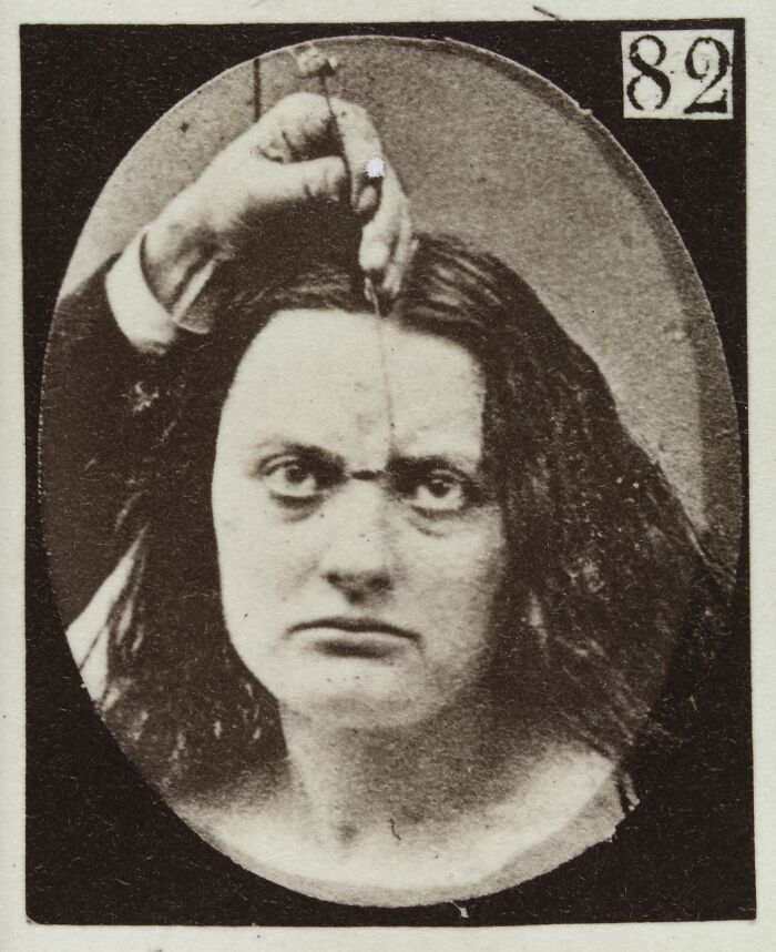Woman with intense facial expression during a 19th century facial expressions experiment, holding an instrument near her forehead.