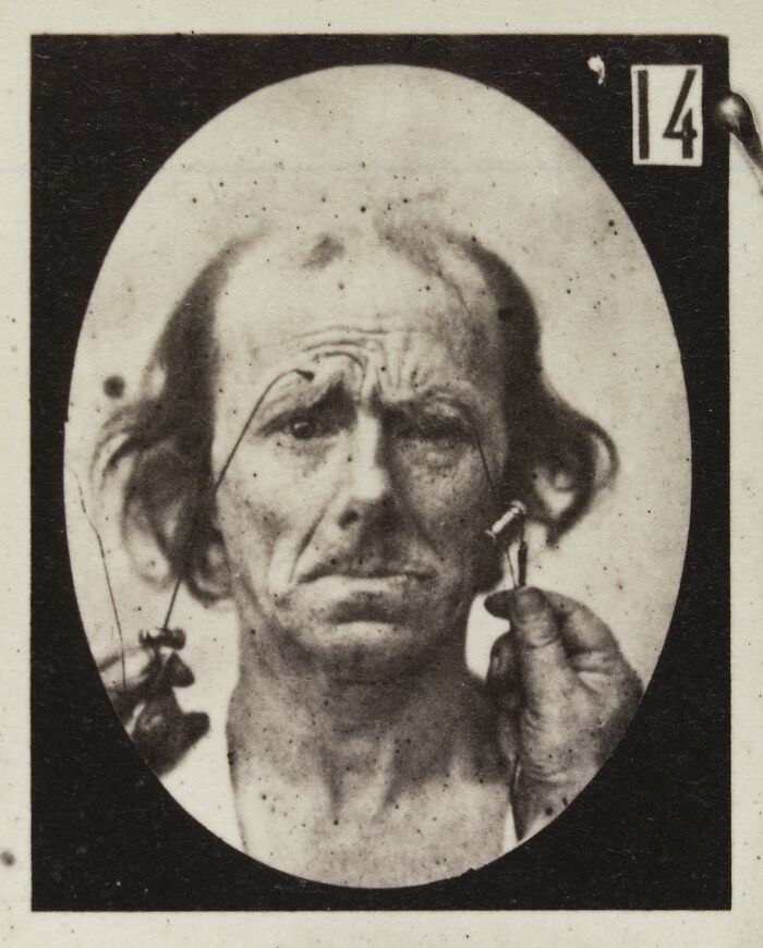 19th century facial expressions experiment showing a man with manipulated face in black and white portrait.