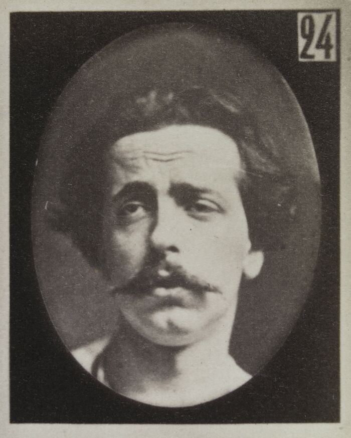 Black and white 19th century photo of a man showing a distressed facial expression for experiment.