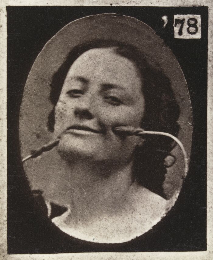 19th century facial expressions experiment showing a woman with tools manipulating her smile in a vintage black and white photo