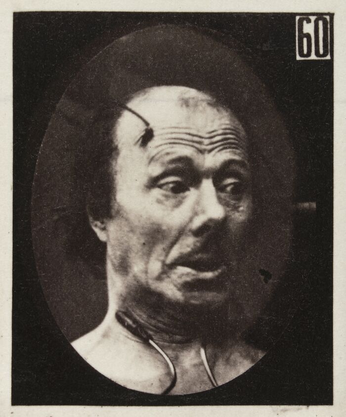 Black and white 19th century facial expressions experiment showing a man with a distressed and shocked look on his face.