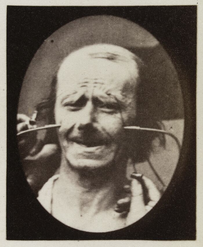 Close-up of a man making a pained facial expression during a 19th century facial expressions experiment.