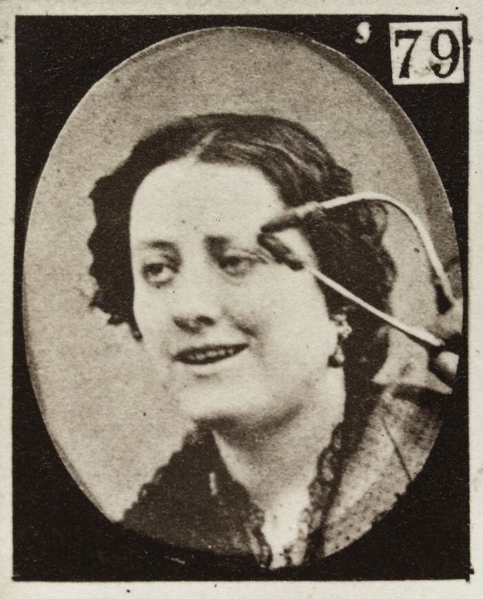 Black and white vintage photo of a woman with unusual facial expression during a 19th century facial expressions experiment.