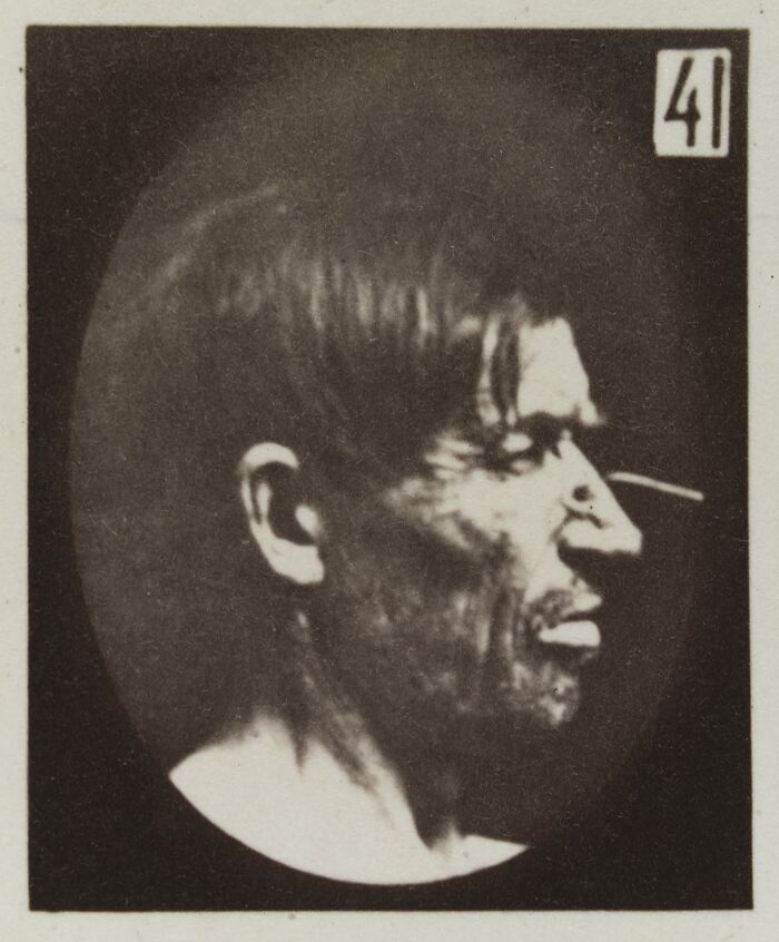 Black and white 19th century facial expressions experiment photo showing a man's distressed or pained profile expression.