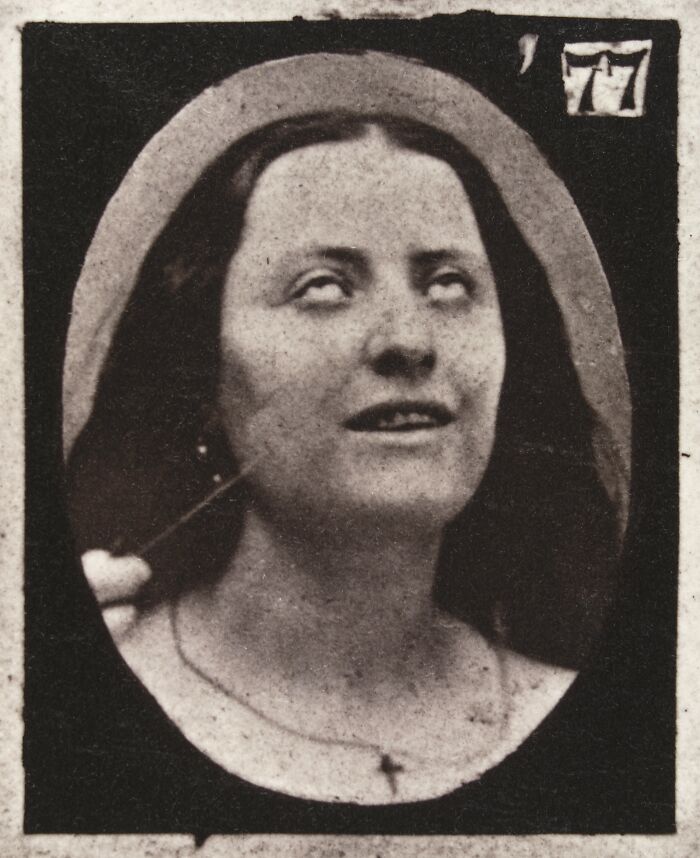 19th century facial expressions experiment showing a woman with eyes rolled back, evoking eerie and unsettling emotions.