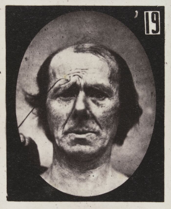 Black and white photo from a 19th century facial expressions experiment showing a man with a distressed expression.