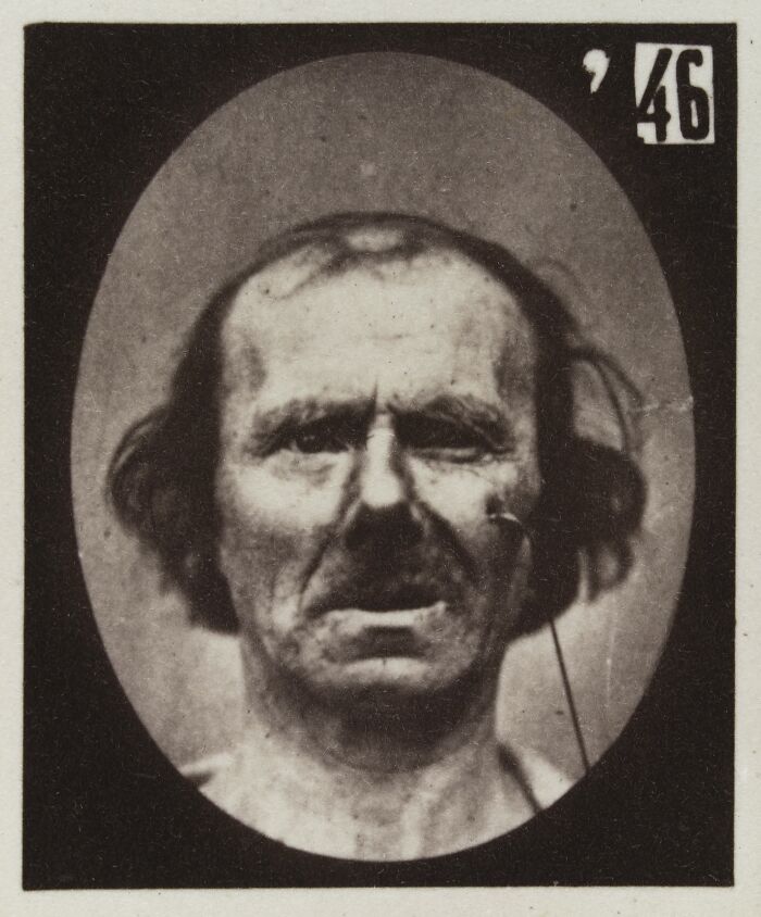 Black and white 19th century facial expressions experiment photo showing a man with a distressed and intense expression.