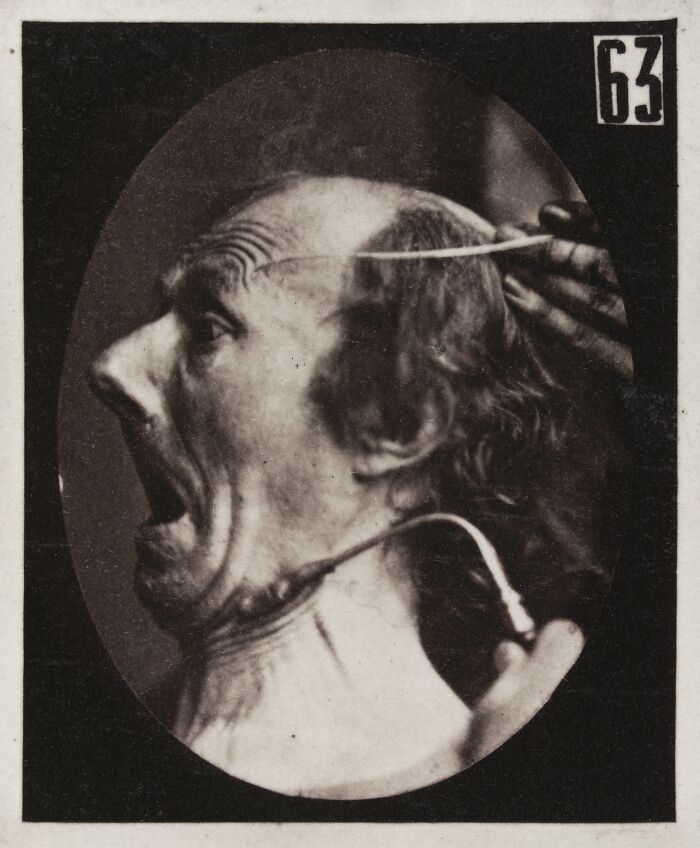 Black and white photo from a 19th century facial expressions experiment showing a man with a shocked, fearful expression.
