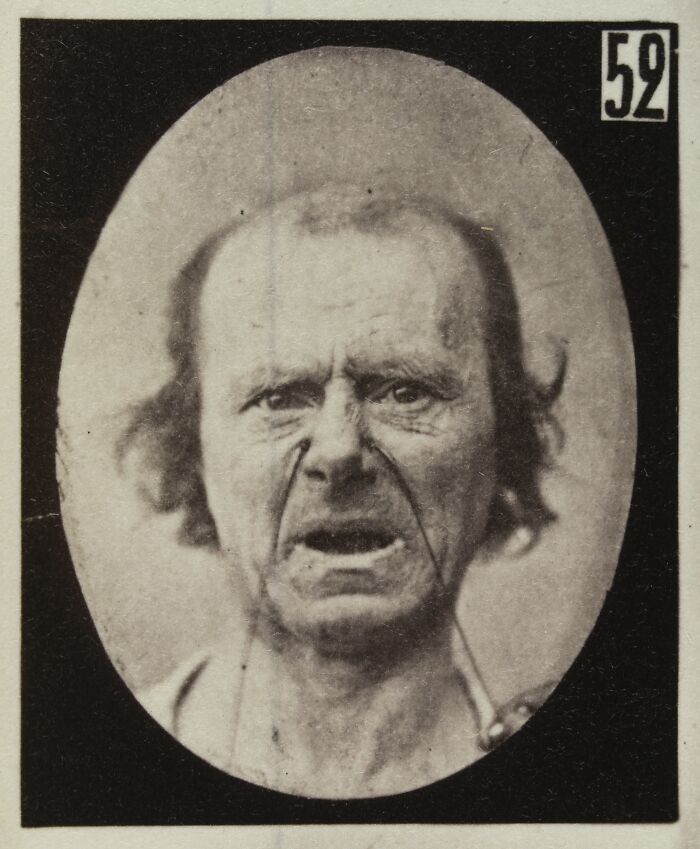 Black and white photo of a distressed man showing a facial expression from a 19th century facial expressions experiment.