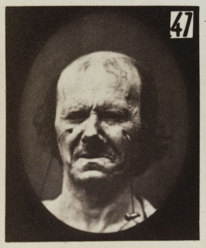 Black and white 19th century facial expressions experiment photo showing a grimacing man with intense emotions.