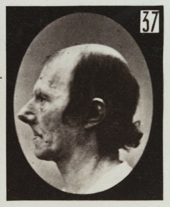 Black and white 19th century facial expressions experiment photo showing a man in profile with a distorted face.