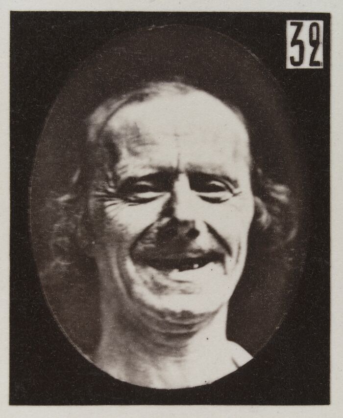 Black and white 19th century facial expressions experiment photo of an older man with a distorted smile.