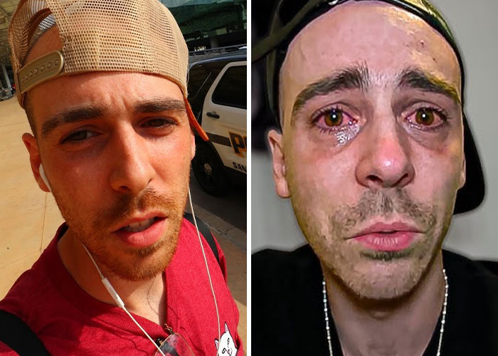 Side-by-side images of a male influencer, one looking neutral outdoors and the other emotional indoors, illustrating influencer career struggles.