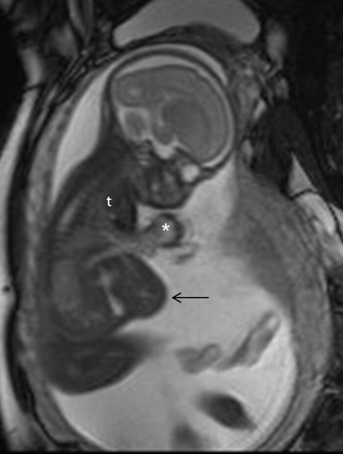 MRI scan showing a rare disease case diagnosed by doctors during patient examination highlighting unusual internal structures.