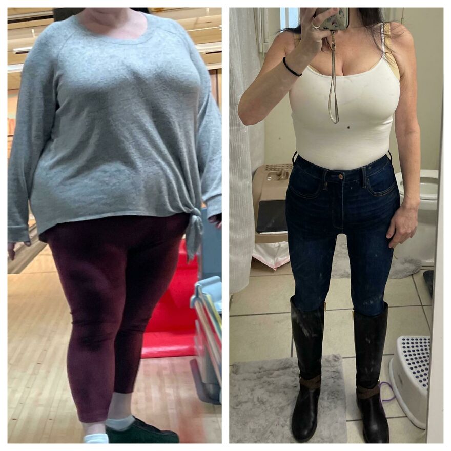 Before and after photos of a woman illustrating weight loss related to Ozempic lawsuit vision loss allegations.