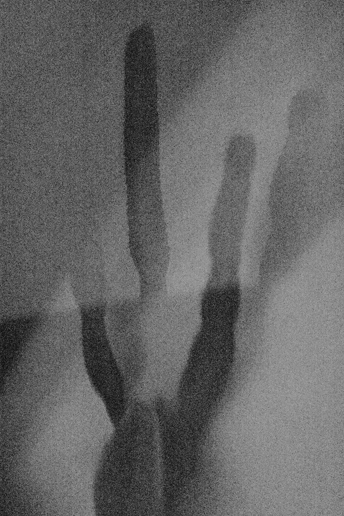 Through Max ISO, I Captured The Fading Mind Of My Father Before He Passed