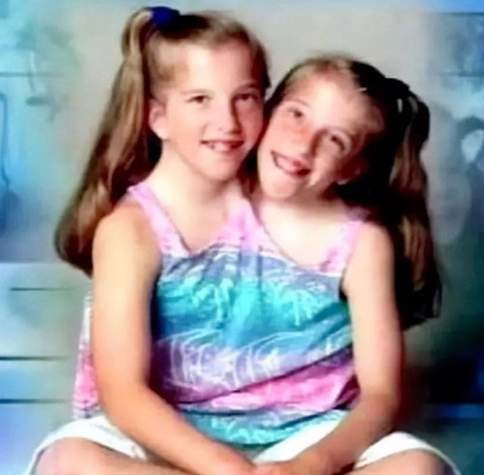 Conjoined twins Abby and Brittany smiling together, showcasing their close bond and unique connection.