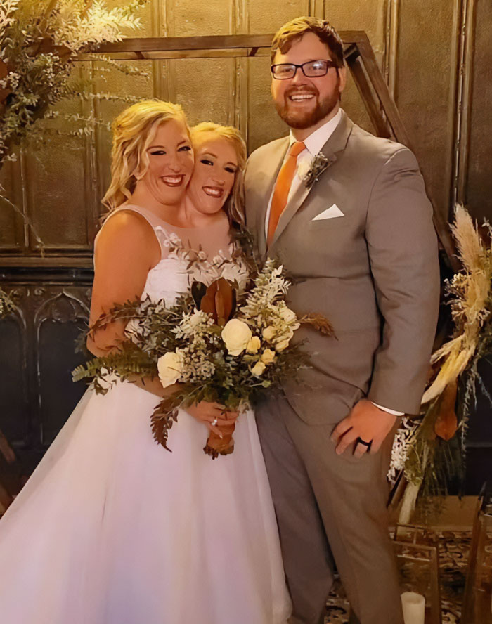 Conjoined twins Abby and Brittany in wedding attire, smiling and holding a floral bouquet with a man in a suit.