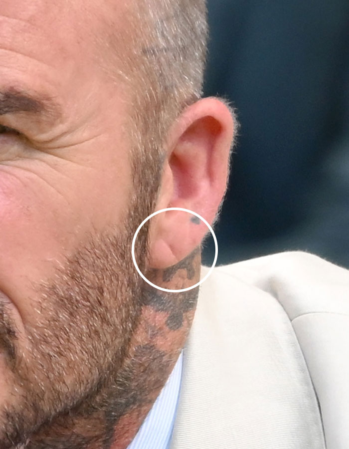 Close-up of Beckham's ear and neck tattoo showing a sign that a doctor considers dangerous on Beckham's body.