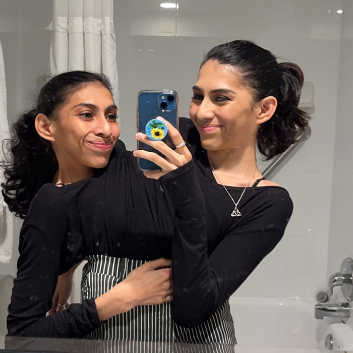 Conjoined twin taking a mirror selfie with her partner, both smiling and wearing black tops in a bathroom setting.