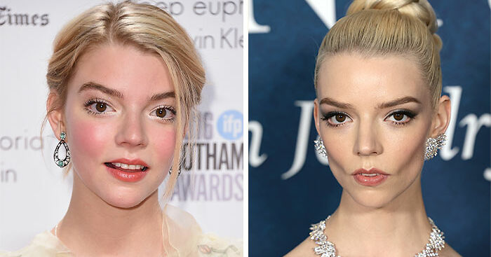 29 Celebrities Fans Believe Ruined Their Beauty With Buccal Fat Removal