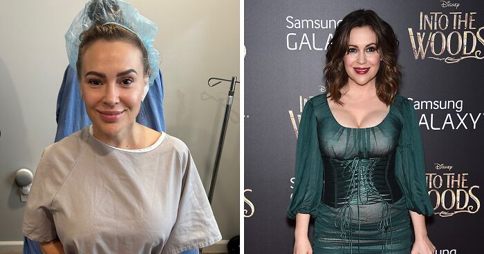 “That Was Never Me”: Alyssa Milano Explains Why She Decided To Remove Her Breast Implants