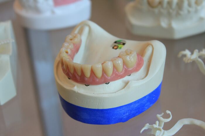 Dental mold with artificial teeth on display, illustrating bizarre messages and phone calls related to unusual dental cases