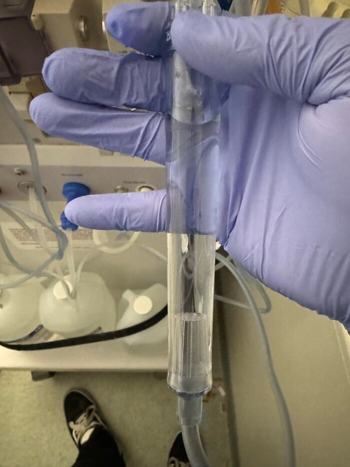 Gloved hand holding a clear medical tube in a clinical setting, representing close-to-death emergency care equipment.