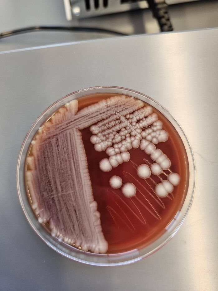 Close-up of bacterial colonies growing on a petri dish, illustrating dangers people faced that were nearly deadly.