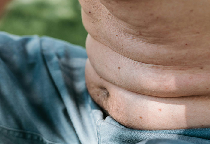 Close-up of a person's midsection showing skin folds and body hair, illustrating poor hygiene concerns among partners.
