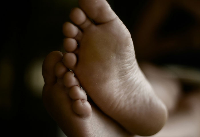 Close-up of bare feet showing poor hygiene, highlighting the impact of bad hygiene on partners and relationships.