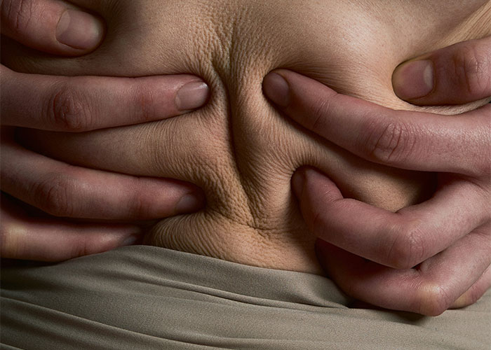 Close-up of a person pinching wrinkled skin on their back during a funny and embarrassing doctor’s appointment scene.