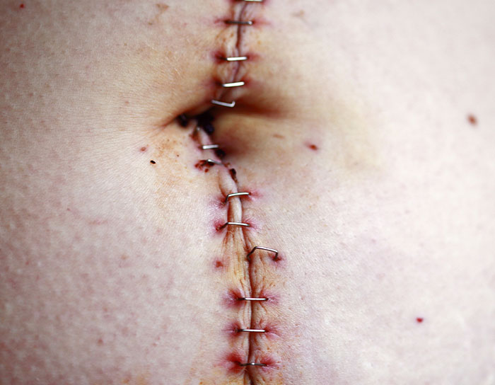 ER Nurses Share Wild “One More Minute And I’d Be Dead” Stories From The Hospital