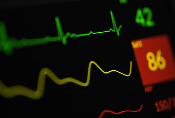 Close-up of a heart monitor display showing vital signs as healthcare workers share one more minute and I’d be dead stories.