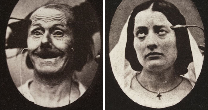 45 Creepy Photographs Of Facial Expressions That Were Part Of A 19th-Century Experiment
