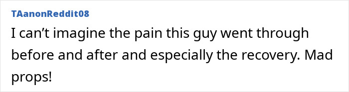 Comment on Reddit expressing empathy for the folded boy's pain and recovery, praising his resilience and effort.