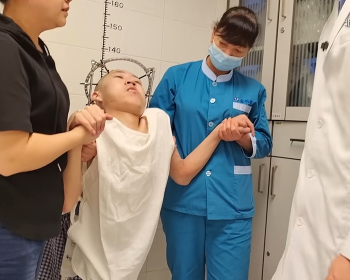 Young folded boy supported by medical staff as he attempts to stand up straight after long-term bending condition.