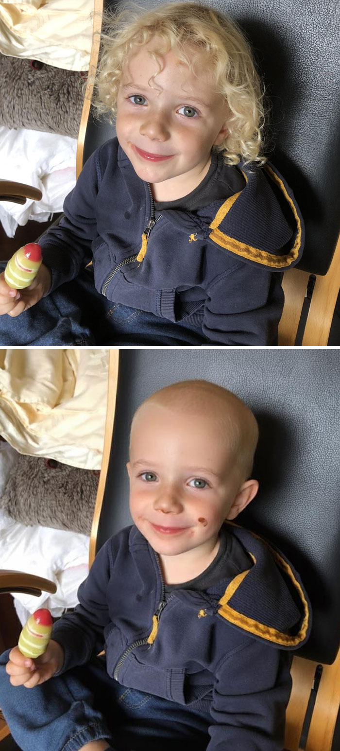 Before and after photo edits of a child with curly hair transformed into a bald head, showing unexpected photo edit results.