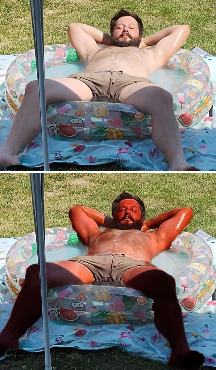 Man relaxing in a kiddie pool with unexpected and humorous photo edits showing extreme sunburn effect.