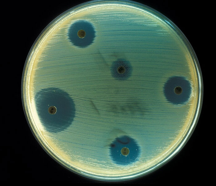 Petri dish showing antibiotic resistance zones as a weird and iconic bruh moment in history science experiment.