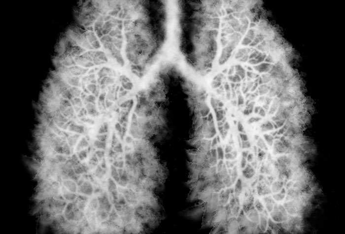 Detailed X-ray scan showing human lungs with intricate airways for a daily dose of fascinating knowledge.