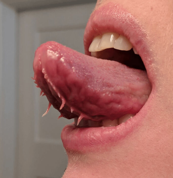 Close-up of a unique tongue showing rare and surprising things about their bodies with small hair-like growths.