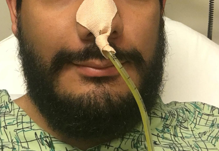 Man with a nasogastric tube taped to his nose, illustrating downplayed medical conditions and procedures.