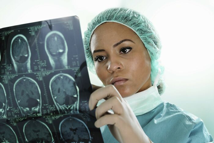 Medical professional examining brain scans, highlighting patients who defied every medical odd with focused attention.