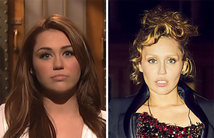 Two female celebrities side by side, highlighting facial features commonly linked to buccal fat removal.