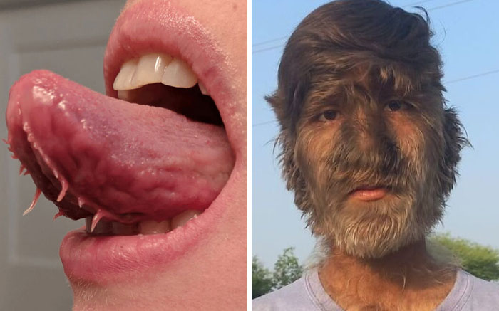 50 Photos Of Human Body Quirks That Are Both Fascinating And Shocking