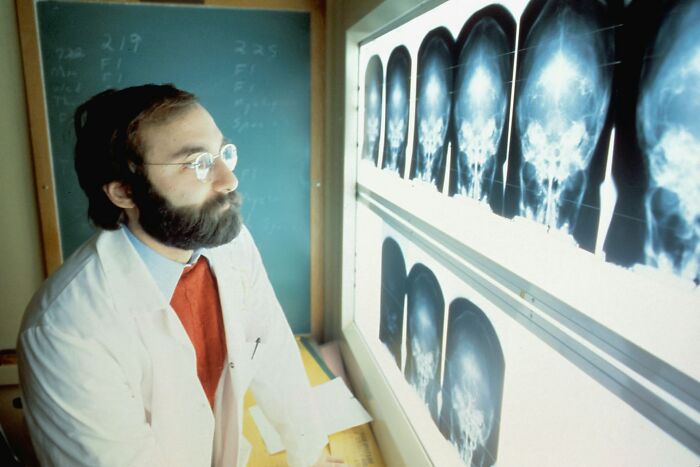 Doctor examining rare disease patient skull X-rays on a lightbox in a medical office setting.