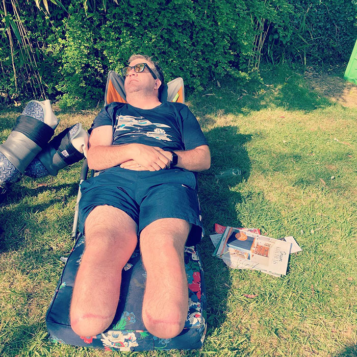 Man with amputated legs lying outdoors on a reclining chair in a sunny garden, representing surgeon with self-amputation case. Man with amputated legs lying outdoors on a reclining chair in a sunny garden, representing surgeon with self-amputation case.